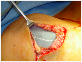 figure 2.tiff